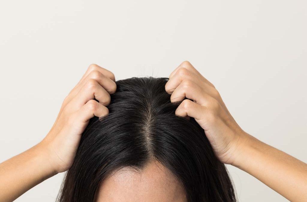 On Hair Loss and Scalp Health