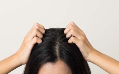 On Hair Loss and Scalp Health